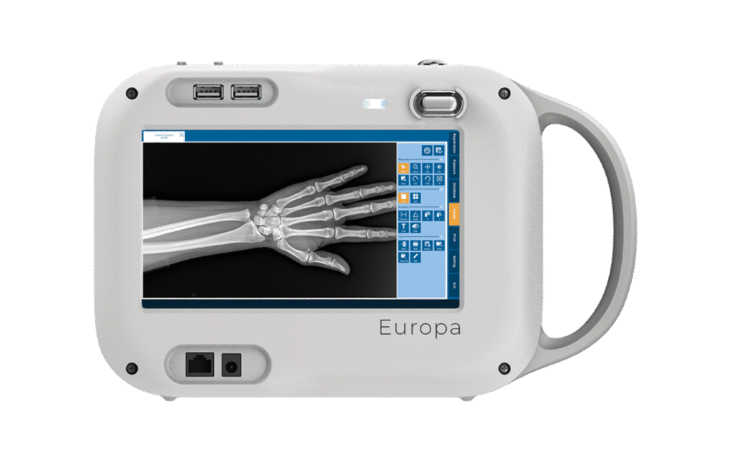 Revolutionizing Mobile Diagnostics